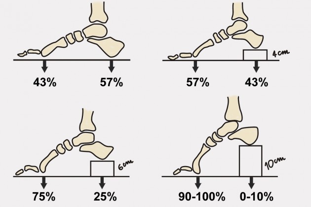 Bandáž na Hallux Valgus AM-OP-01